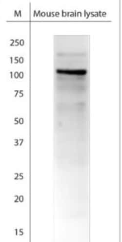 TRPA1 Antibody, Novus Biologicals 0.025 mL; Unconjugated:Antibodies, Polyclonal